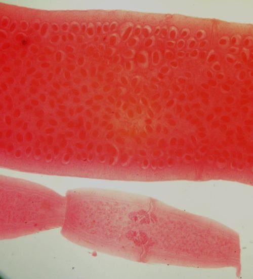 Dipylidium caninum
