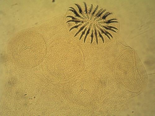 Taenia solium