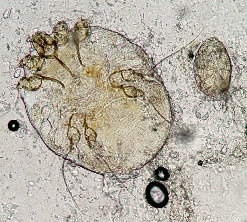 Sarcoptes scabiei