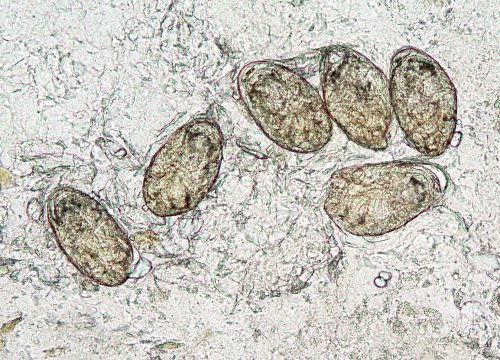 Sarcoptes scabiei