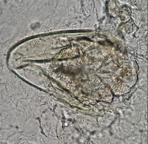 Sarcoptes scabiei