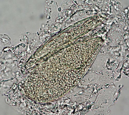 Sarcoptes scabiei