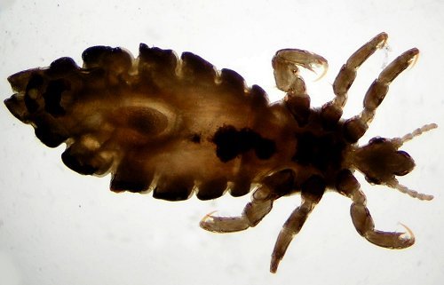 Pediculus capitis
