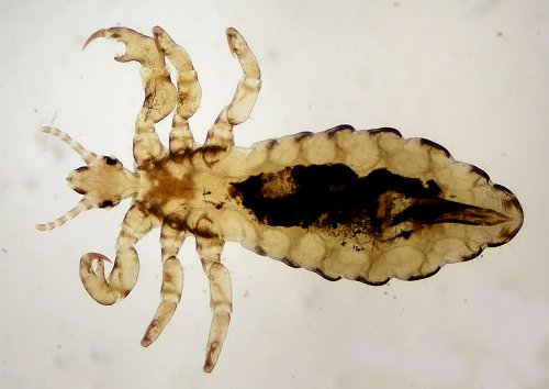 Pediculus capitis