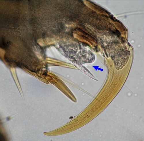 Pediculus capitis