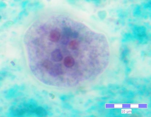 Entamoeba coli