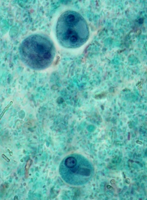 Entamoeba dispar