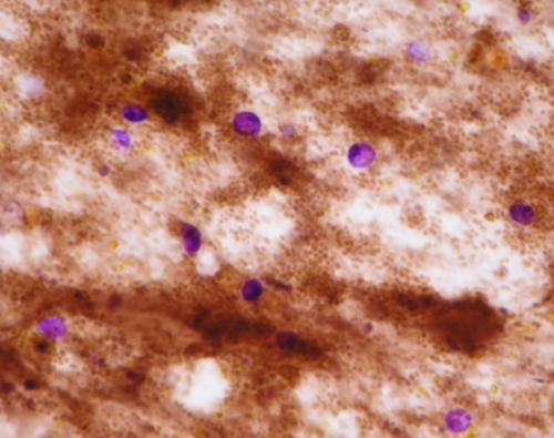 Cryptosporidium parvum
