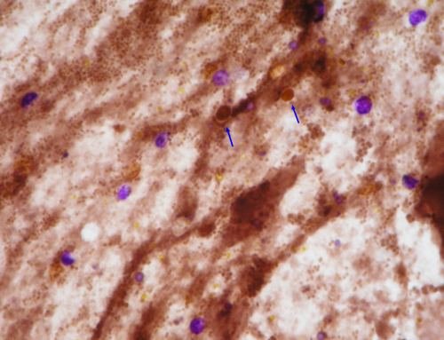 Cryptosporidium parvum