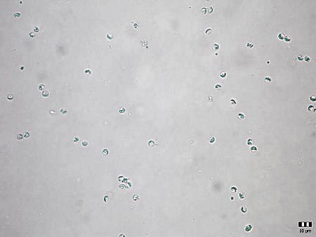 Cryptosporidium parvum