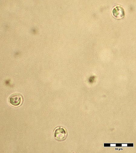 Cryptosporidium parvum