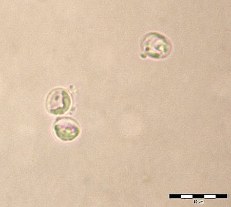 Cryptosporidium parvum