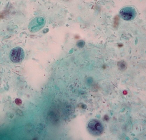 Giardia intestinalis