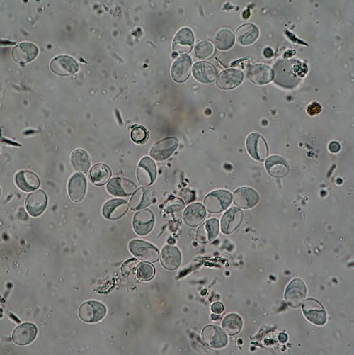 Giardia intestinalis