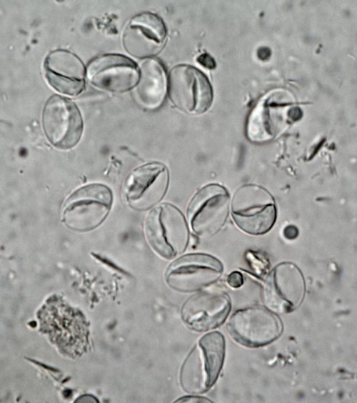 Giardia intestinalis