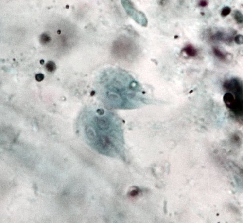 Giardia intestinalis