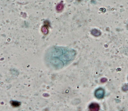 Giardia intestinalis