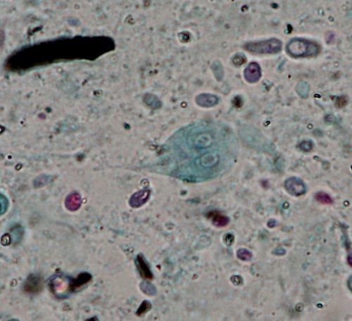 Giardia intestinalis