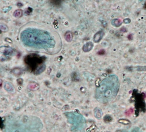 Giardia intestinalis