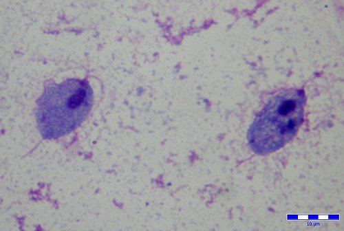 Trichomonas vaginalis