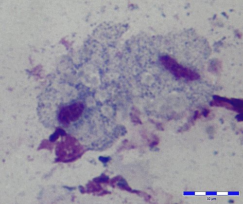Trichomonas vaginalis