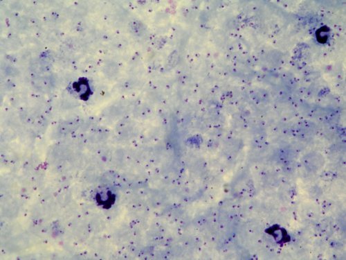 Apicomplexa