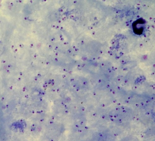 Plasmodium falciparum