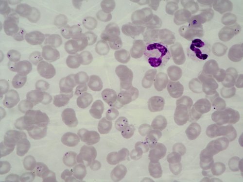 Plasmodium falciparum