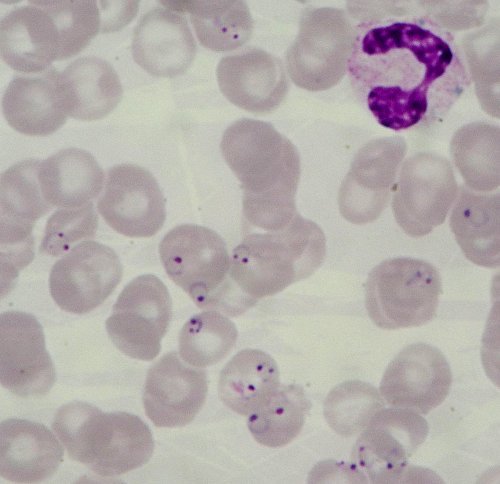 Plasmodium falciparum