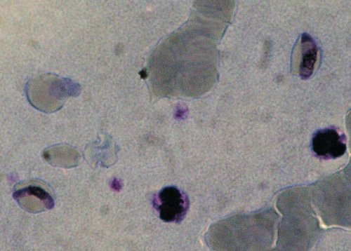 Plasmodium falciparum