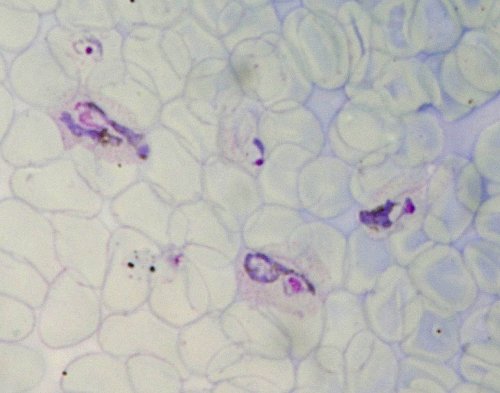 Plasmodium vivax