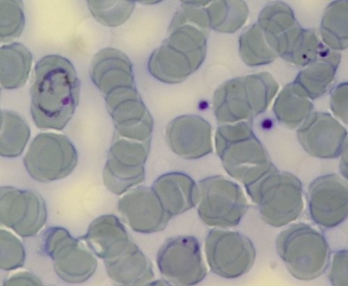 Plasmodium vivax
