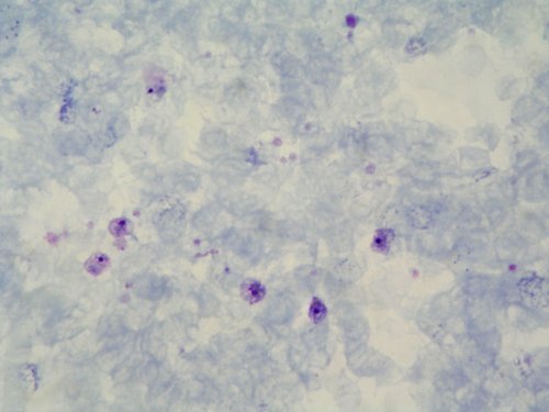 Plasmodium ovale