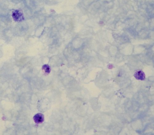 Plasmodium ovale