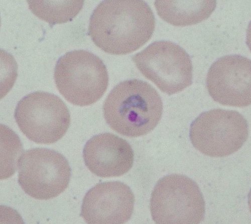 Plasmodium ovale