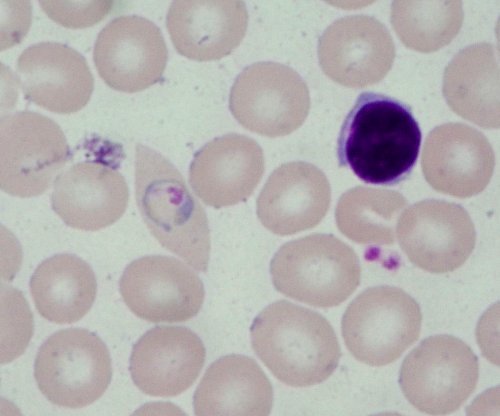 Plasmodium ovale