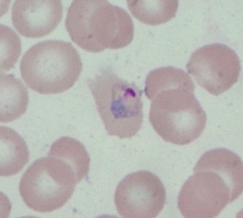 Plasmodium ovale