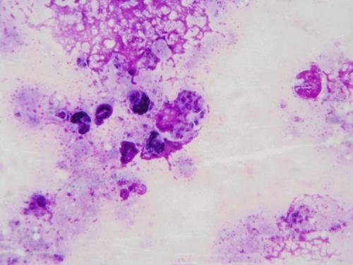 Saccostoma