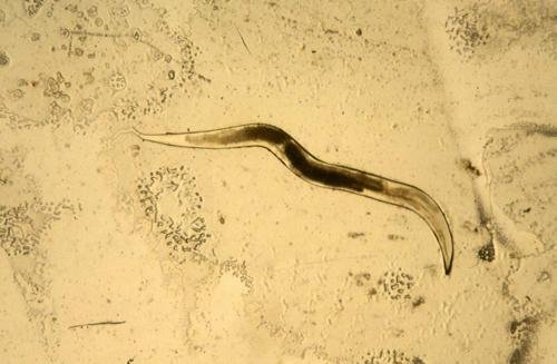 Enterobius vermicularis
