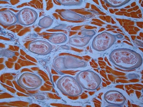 Trichinella spiralis