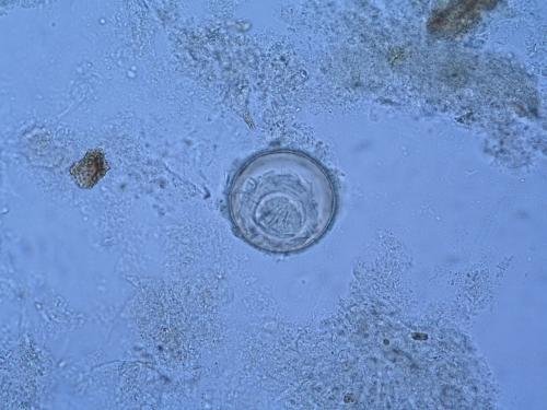 Hymenolepis diminuta