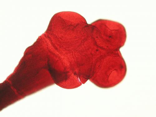 Taenia saginata