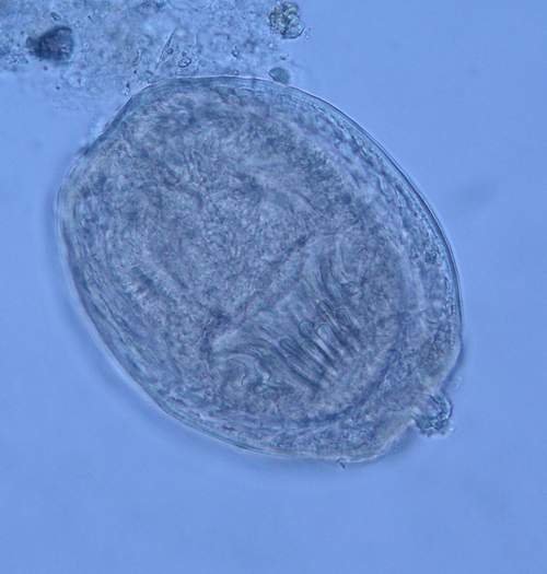 Echinococcus granulosus