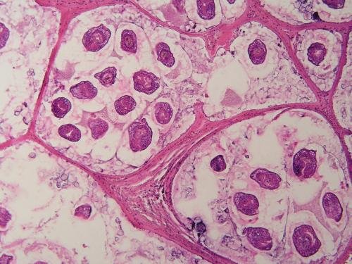 Echinococcus multilocularis
