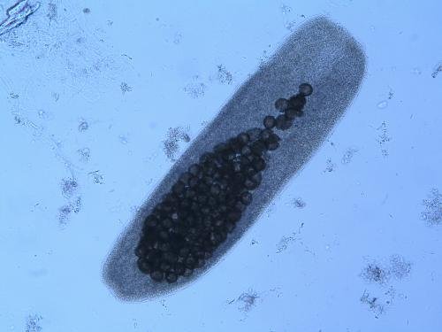 Echinococcus multilocularis