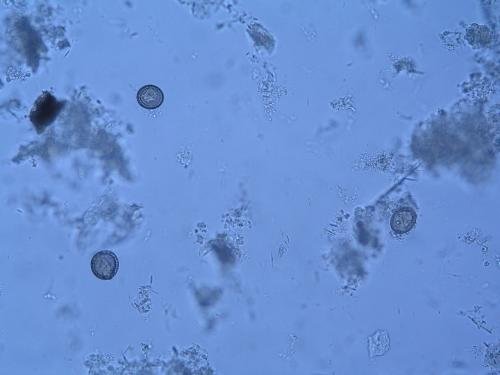 Echinococcus multilocularis