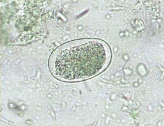 Ancylostoma duodenale