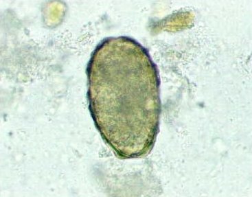 Ascaris lumbricoides