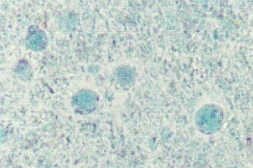 Blastocystis hominis