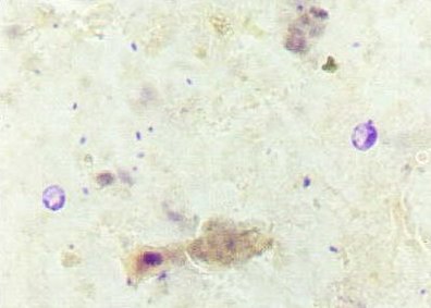 Cryptosporidium parvum